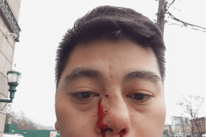 36岁华人遭一元店黑人员工嫌弃英文差，被殴打至颅内出血！