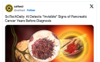 AI对抗“癌王” 人工智能可望提前数年揪出胰脏癌踪迹