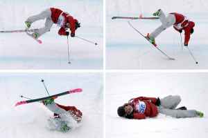 受伤的滑雪者让魁北克医院急诊室不堪重负