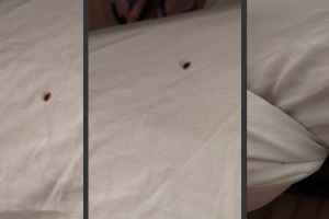 一臭虫横行的Airbnb短租屋让法国游客在蒙特利尔遭遇噩梦